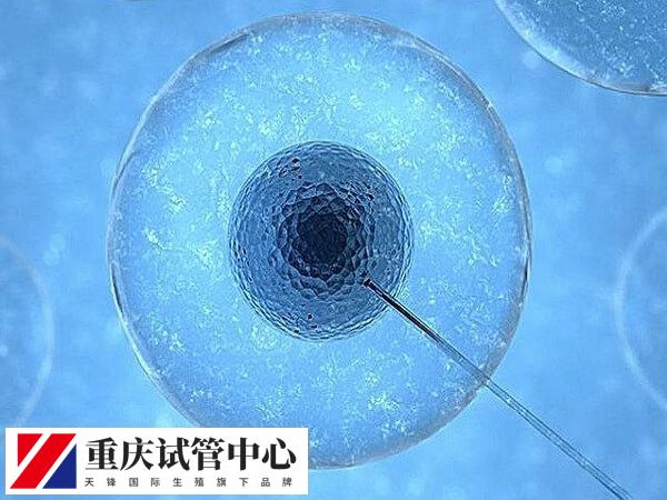 鲜胚移植优缺点是什么