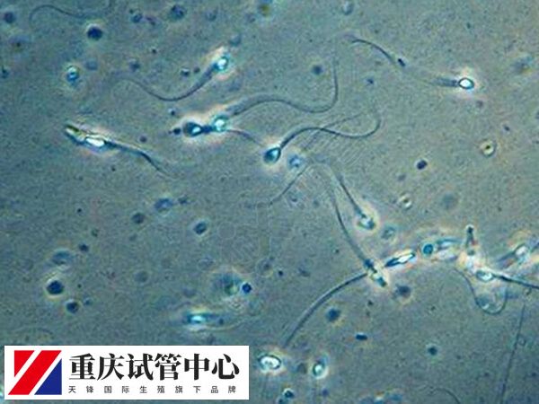 少精症要怎么检查